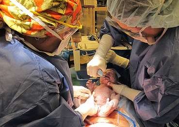 Médicos practicando una cesárea natural con presencia del padre en el quirófano