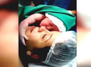 bebe abraza a su madre recien nacido cesarea