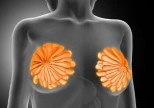 pecho cancer glándulas mamaria reconstruccion mamaria