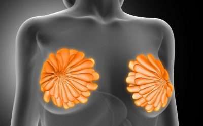 Cómo realizar la autoexploración del pecho