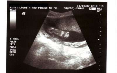 El desarrollo del feto en el primer trimestre de embarazo