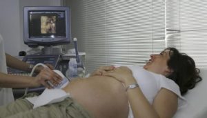 mujer haciéndose ecografía o prueba médica del embarazo