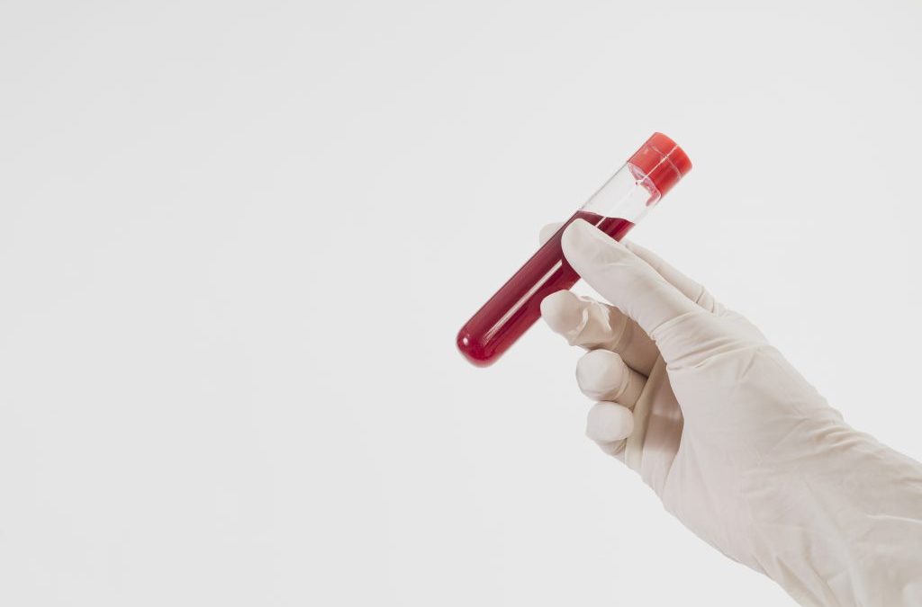 analisis de sangre test adn test serologico
