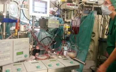 Trasplantan un corazón a un bebé con grupo sanguíneo incompatible