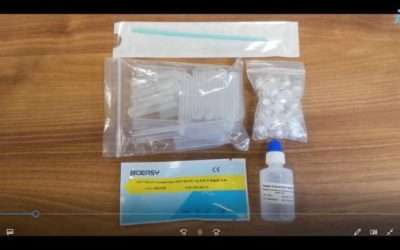 Cómo funciona el test rápido del coronavirus