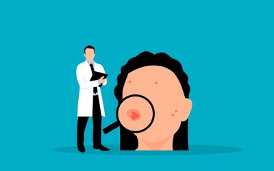 Infecciones en la piel, el impétigo: síntomas y tratamiento