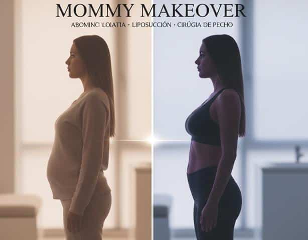Mommy Makeover